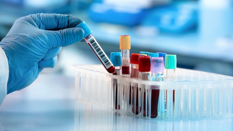 Autoimmune Disease Diagnostics; Depends On the Identification of Disease-Associated Clinical Symptoms