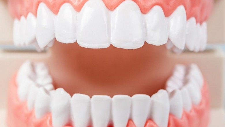 How To Take Care of Your Teeth with Invisalign?