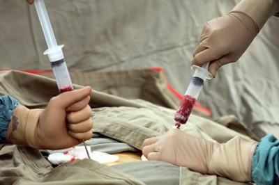 Bone Marrow Transplant Market Size, Trends, Shares and Insights