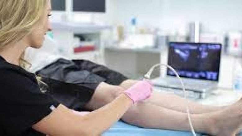 Harvard Trained Vein Doctor San Diego