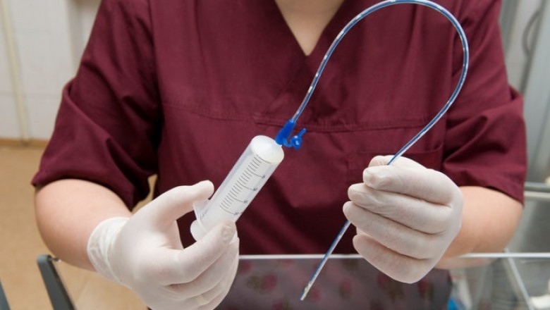 Because of the rising burden of chronic disease in developed countries, the enteral feeding device market is expected to grow significantly in the near future.