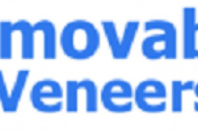 Clip On Smile Veneer