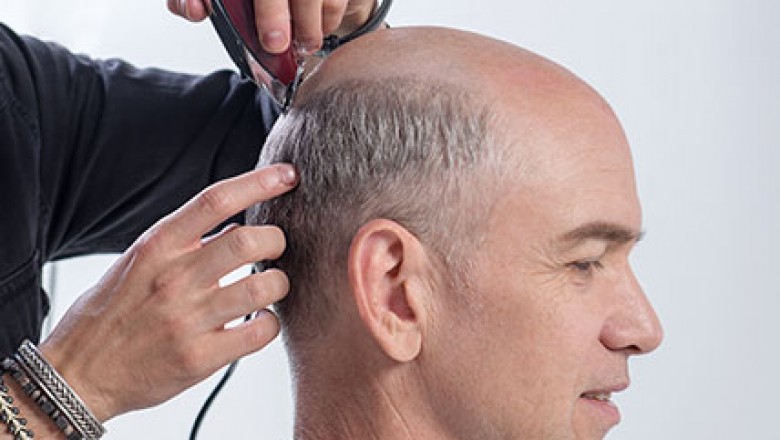 development of hair pieces for men