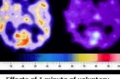 Buteyko practitioner training