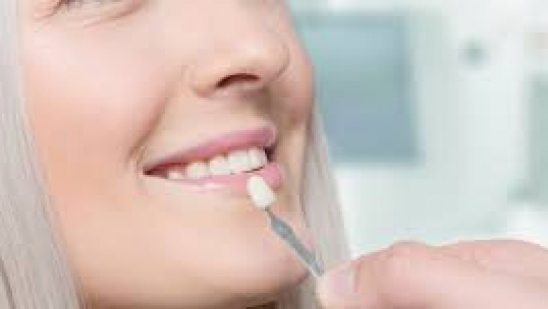 Get Everything Clear Prior To Acquiring Dental Veneers