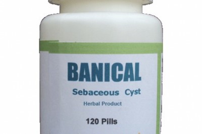 Treatment for Sebaceous Cyst | Remedies | Herbal Care Products