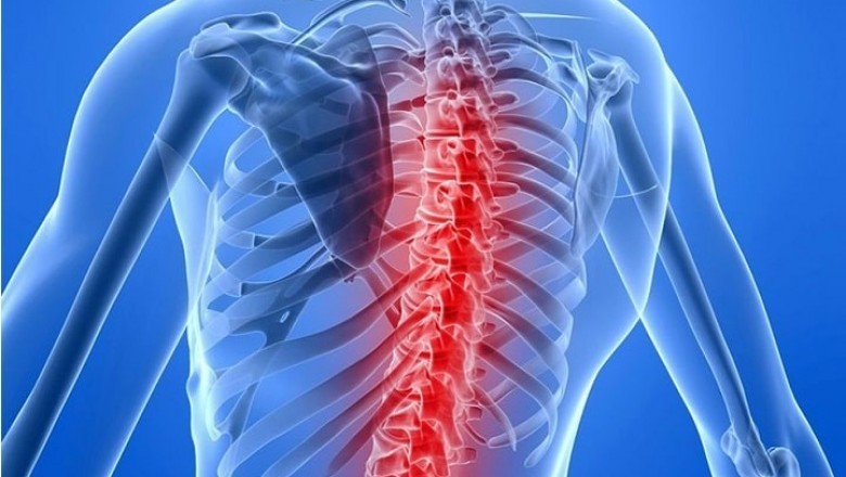 The nerve system and skeletal muscles are significantly affected by spinal muscular atrophy, a degenerative neurological disorder.