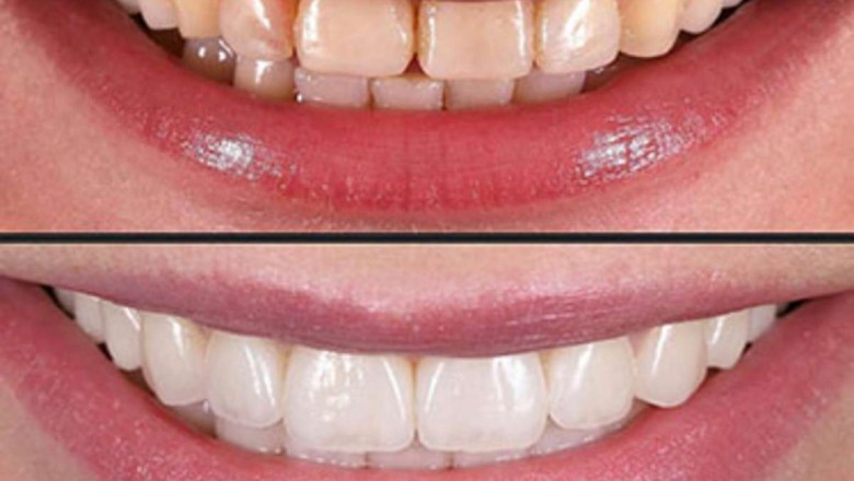 Cosmetic Dentist In Houston Tx