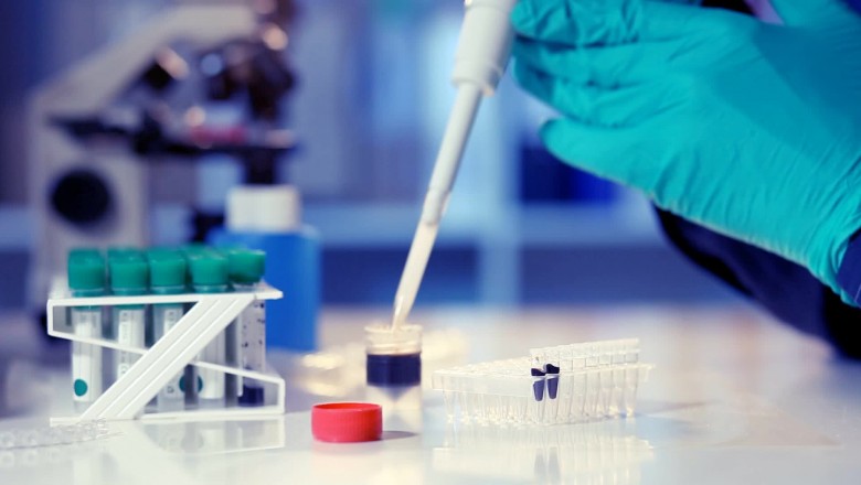 Full body checkup price in Delhi