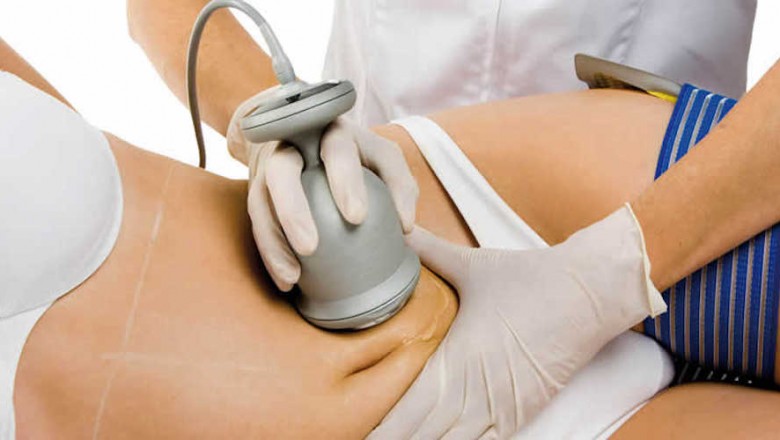 This Week's Top Stories About Cavitation Machine