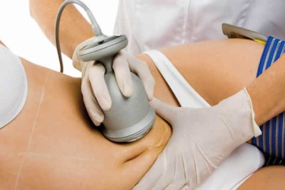 This Week's Top Stories About Cavitation Machine