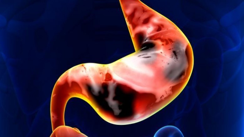 Celltrion Inc., a South Korean drug manufacturer, continues to expand the global stomach cancer drugs market. For its biosimilar, the company receives the WHO Prequalification Standards.