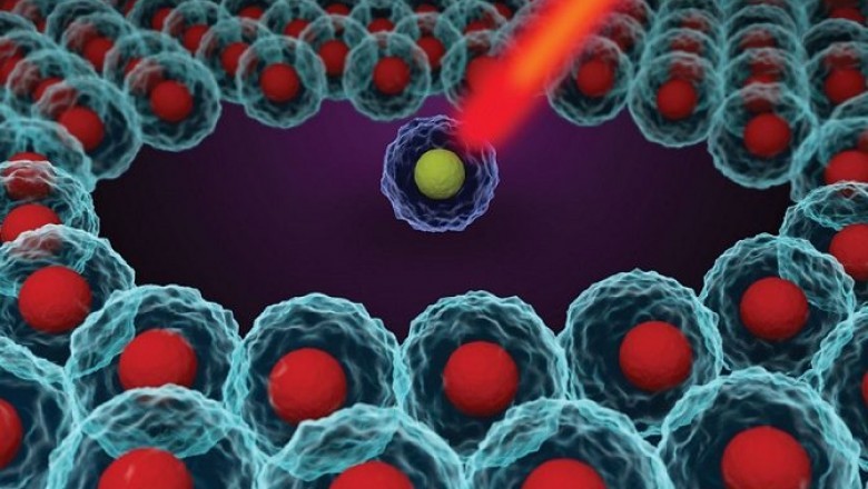 Single Cell Genome Sequencing Helps Identify the Root Cause of Many Chronic Diseases