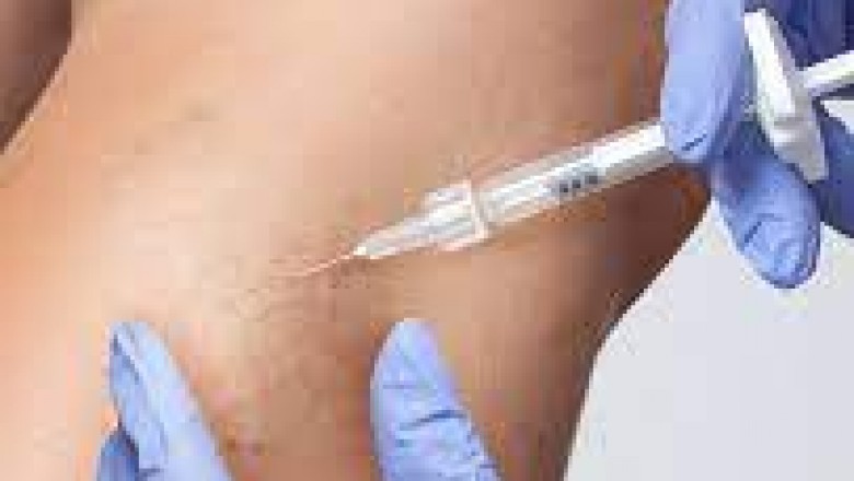 Getting Veins Treatment: Must Avoid Some Mistakes