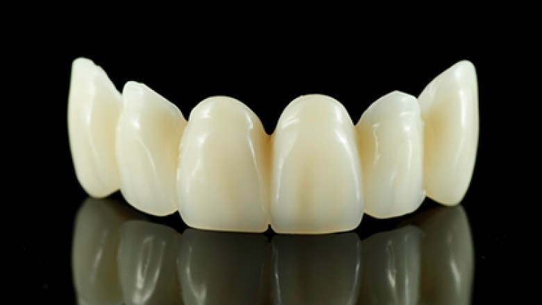 Dental Crowns: Don't Worry About Dental Crown