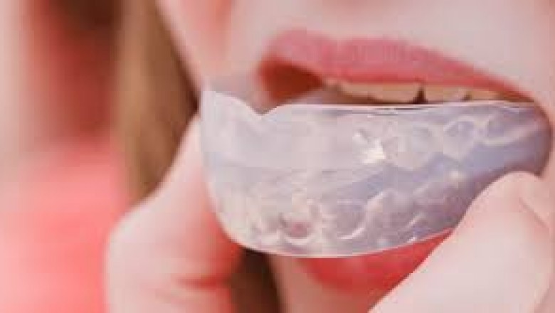 night mouth guard sleeping