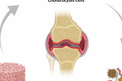 Growth in Sales of Europe Allogeneic Human Chondrocyte Market to Push Revenue Growth in the Market