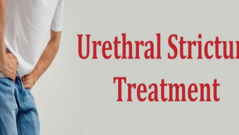 Urethral Stricture Treatment Market To Surpass US$ 2,120.9 Million By 2027