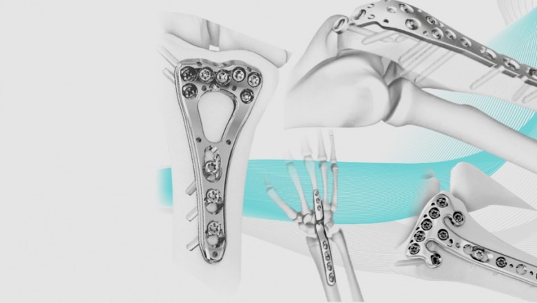 Principales empresas de implantes ortopédicos