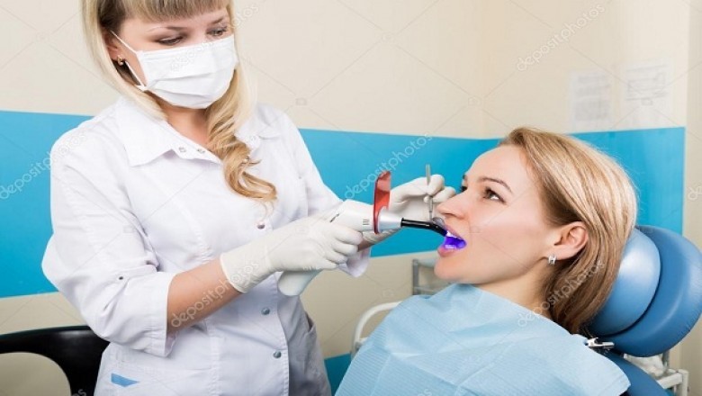 4 Types Of Dental Veneers: