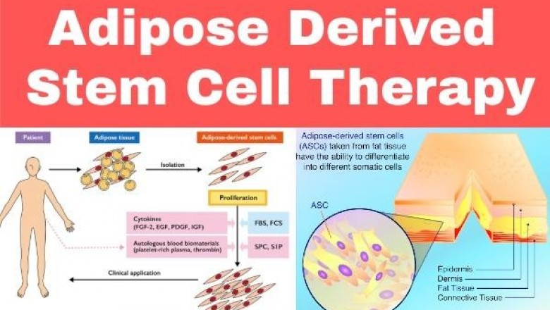 Adipose Derived Stem Cell Therapy Market Size Share Trends Forecast 2026