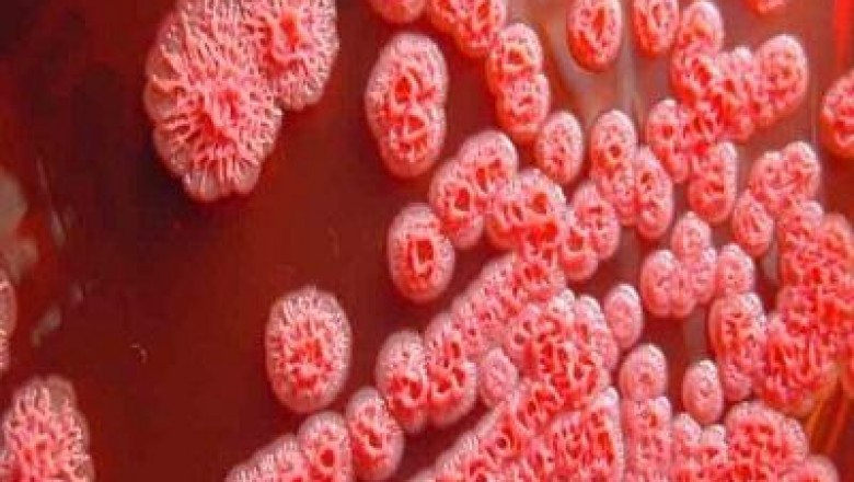 Burkholderia infections are caused by Burkholderia cepacia. It is a gram negative bacillus found in aquatic environment.