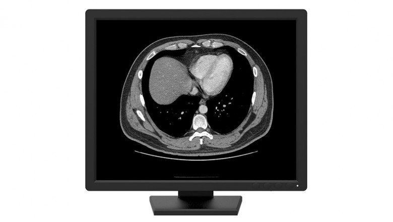 Monochrome medical monitors display image of a single color, however, in varied shades.