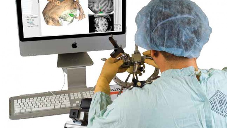 Neuro-navigation Systems Market | Trends,Size, Growth, Share, COVID-19 Impact