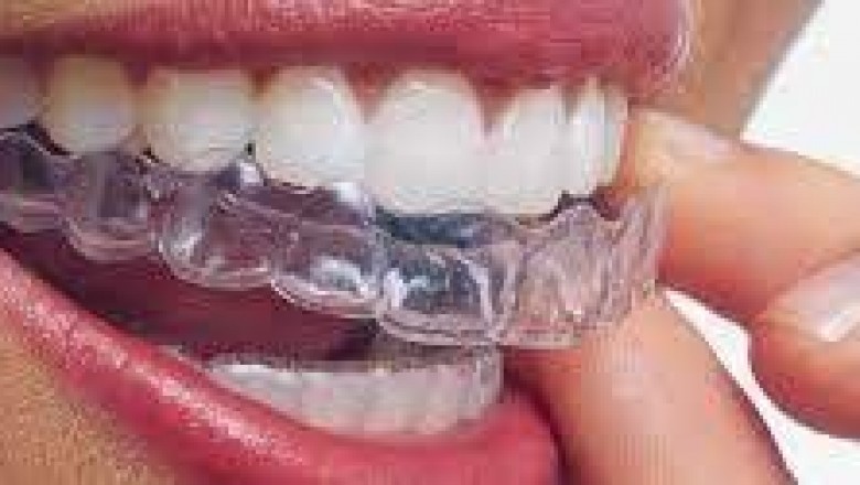 Orthodontist Consultation Aventura North Miami