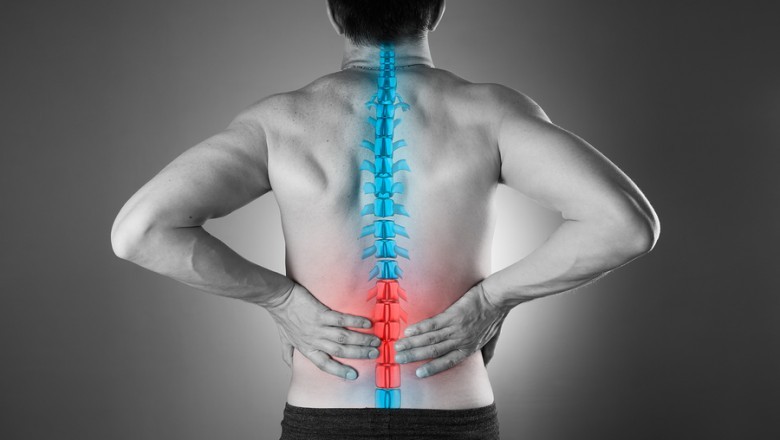 How Slip Disk Might cause Severe Back Pain