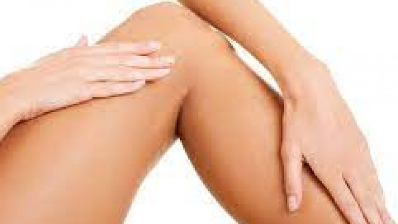 San Jose Vein Treatment Near Me