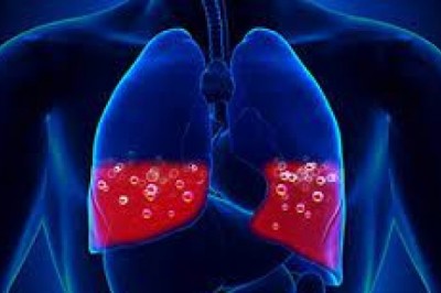 Pulmonary Edema Therapeutics Market Business Segmentation By Revenue And Structure Forecast 2027
