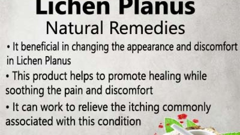 Herbal Treatment for Lichen Planus | Remedies