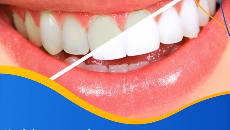 Brighten Your Day with White Teeth | Best Dentist in Emergency