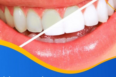 Brighten Your Day with White Teeth | Best Dentist in Emergency