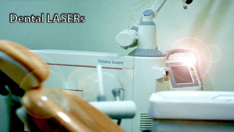 Laser Dental Clinic | Laser Dental Hospital| Laser Dentist in Secunderabad