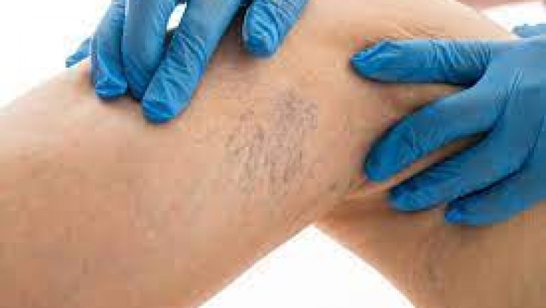 Midtown Vein Doctor Near Me