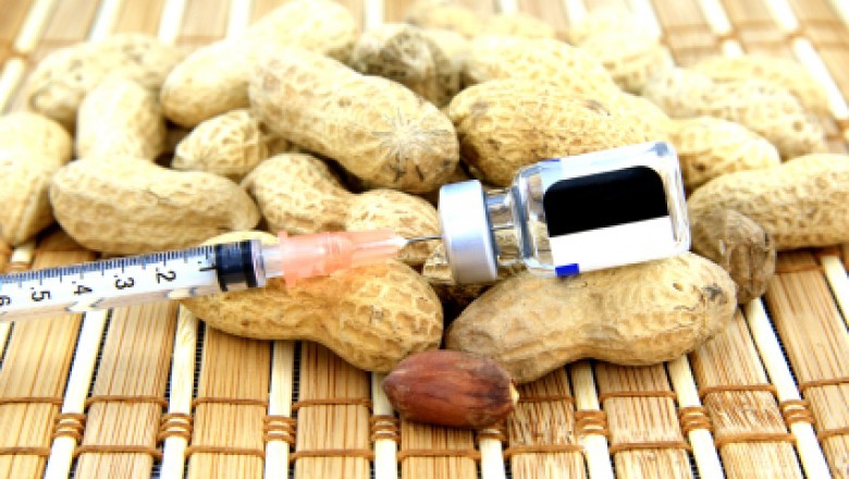 The scope of the global Peanut Allergy Vaccine market report includes a complete analysis of the underlying factors that influence industry trends.