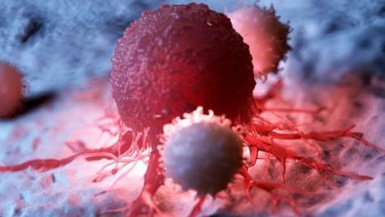 On a variety of types of cancers, surgery is often the only treatment for solid tumors