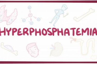 Hyperphosphatemia Drugs Market Size, Trends, Shares, Insights and Forecast – 2018-2026