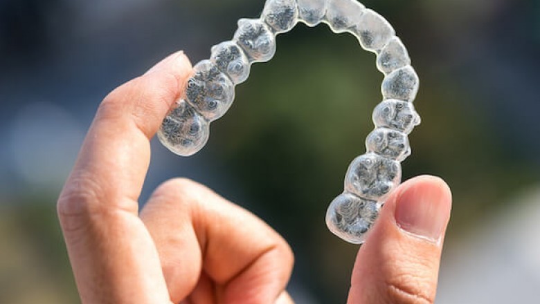 How Teeth Alignment Can Be Done With the Help of Invisalign?