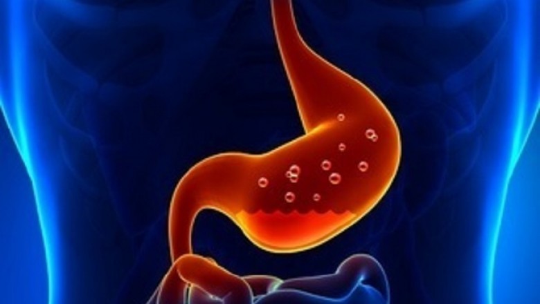 The global stomach cancer drugs market continues to expand thanks to Celltrion Inc., a South Korean company. WHO Prequalification Standards are achieved by the company for its biosimilar.