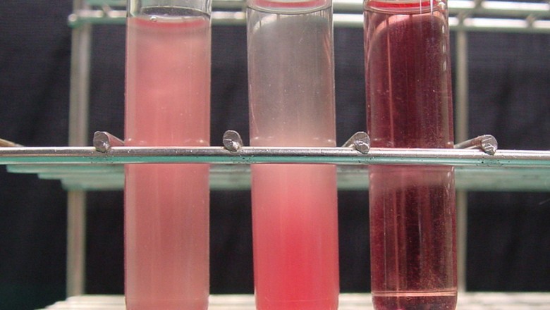 Here Are Some Things You Should Know About Blood Molecular Biology Tubes.