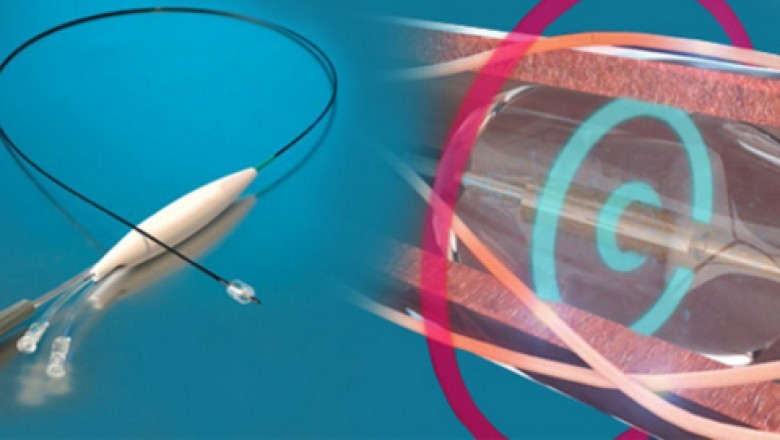 The Renal Denervation Devices Market is gaining traction with the first clinical data ever released from the innovative SPYRAL HTN-OFF MED Pivotal Trial for denervation surgery.
