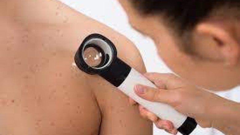 Acute Bacterial Skin and Skin Structure Infections (ABSSSI) are bacterial skin infections that affect the epidermis, dermis, and subcutaneous tissues in North America and Europe.