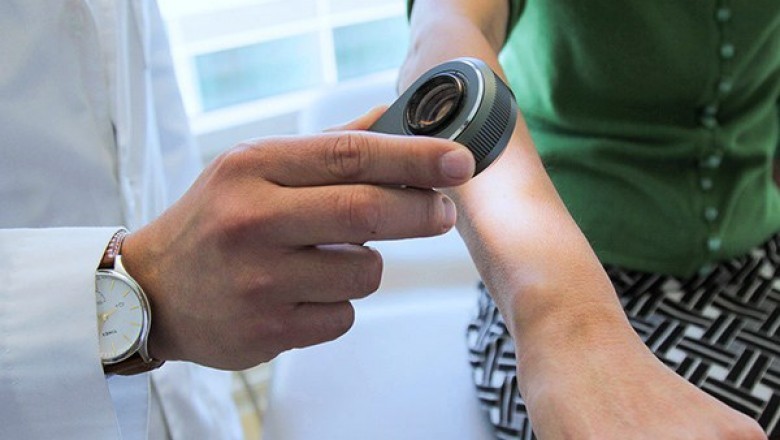 Growing Awareness Among People About the Esthetic Appeal and Technological Advancements in Dermatology Devices are Boosting the Adoption of Dermatology Devices Market