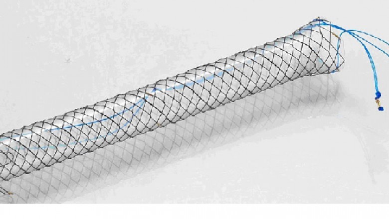 During endoscopic biliary stent placement, it's critical to remember the benefits and drawbacks of both covered and non-covered metal biliary stents.