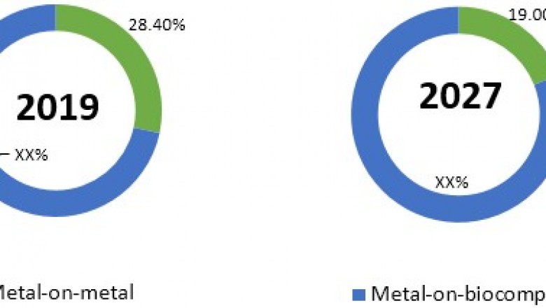 Cervical Total Disc Replacement Devices Market, To Surpass US$ 5,312.8 Million By 2027