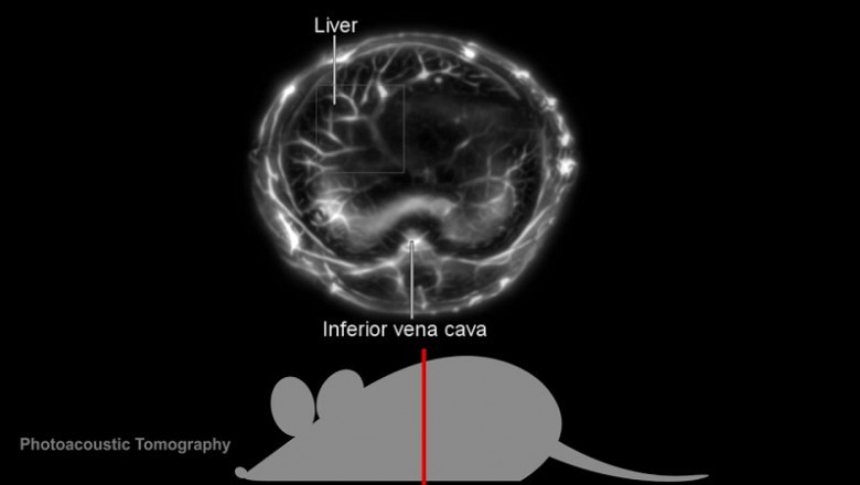 Photoacoustic Tomography Market -Global Industry Trends and Forecast to 2026 | MILabs B.V., Northridge Tri-Modality Imaging, Inc., GENERAL ELECTRIC, Koninklijke Philips N.V. MR Solutions