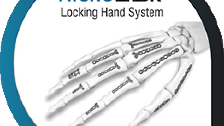 Orthopedic Implants in Estonia